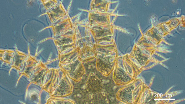 Leica DMLS Trinocular Phase Contrast Microscope (Used) - Image 2